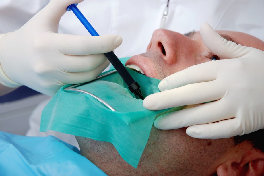 How to Avoid a Root Canal