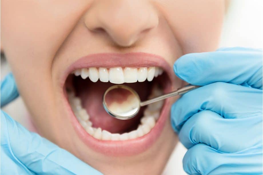 What Lifestyle Choice Are Causing Loss of Tooth Enamel?